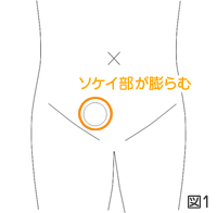 図1イメージ